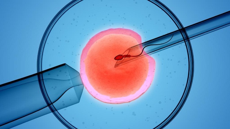 Donor Sperm Insemination