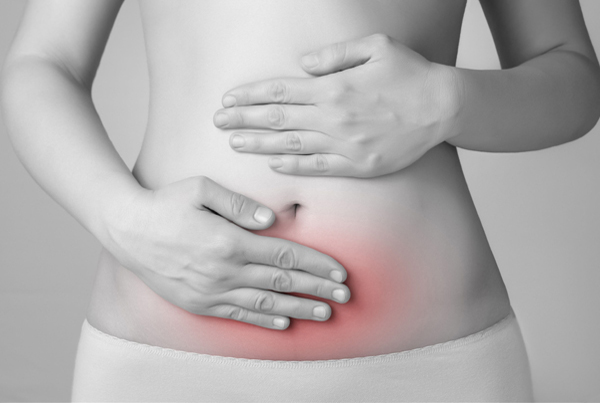 Severe Endometriosis